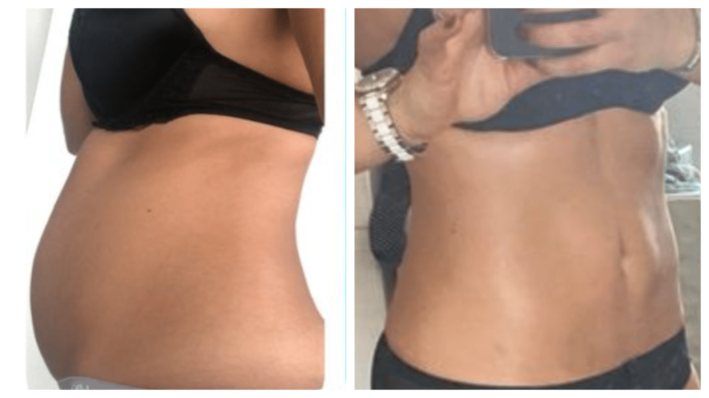 Transformation avant et après d’Anissa