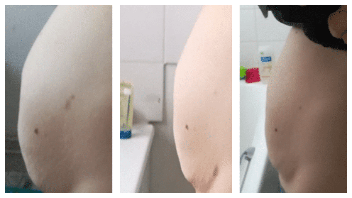 Charlotte, 32 ans, avant et après deux mois