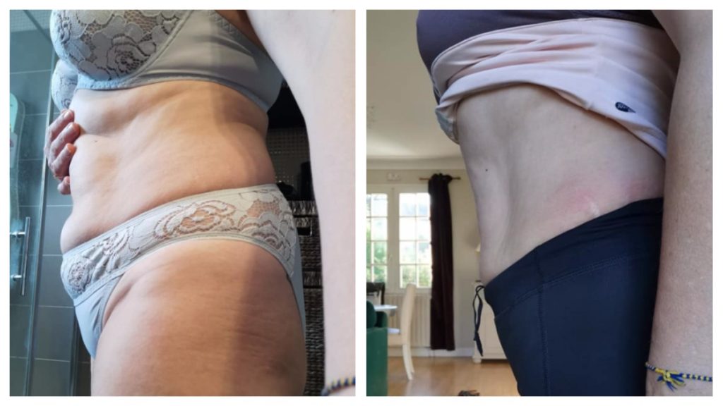 Transformation avant et après d’une Belly