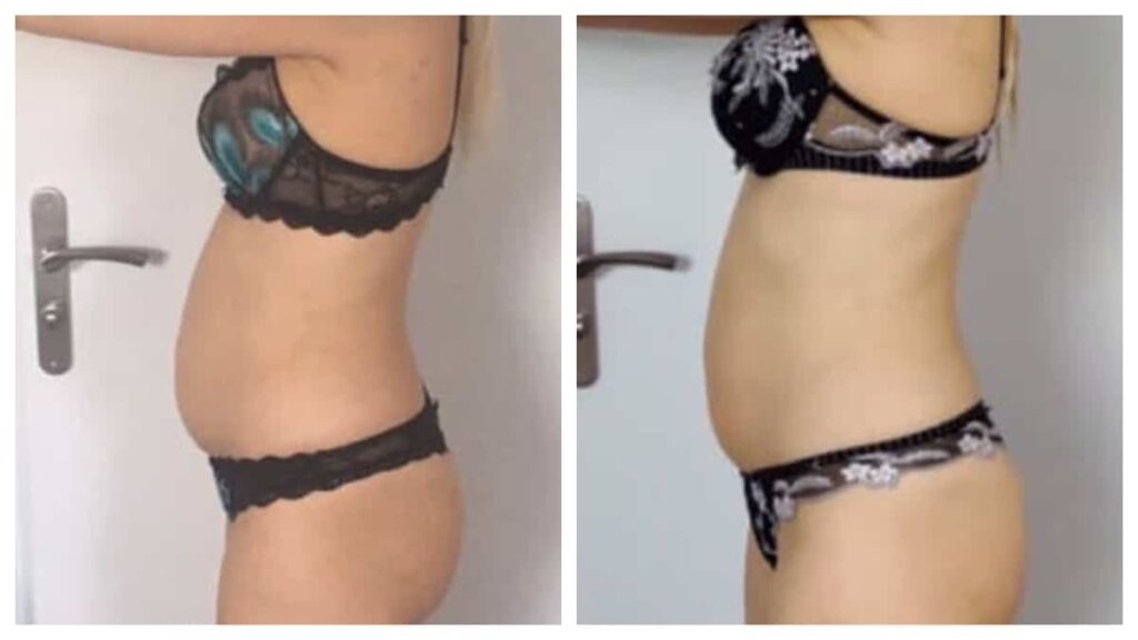Évolution visible obtenue avec The Belly Lab