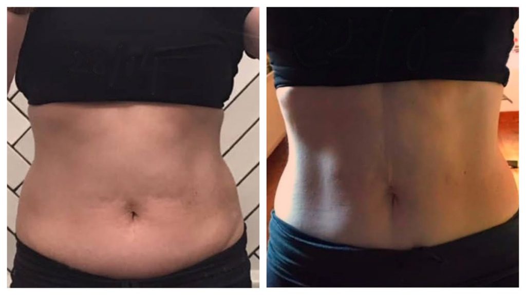 Résultats avant et après avec la méthode The Belly Lab
