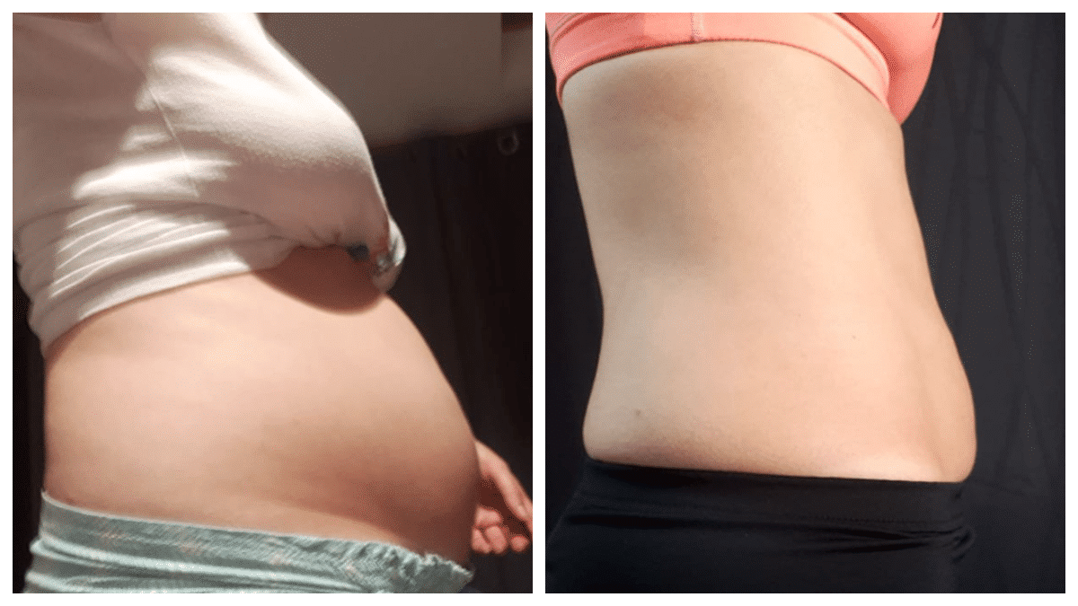 Laetitia, 39 ans, avant et après cinq mois