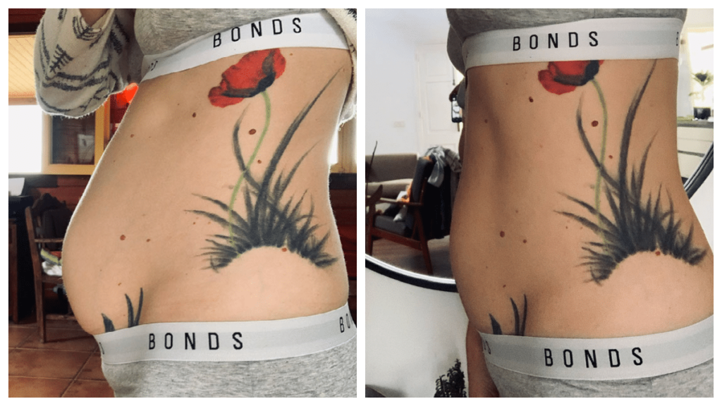 Sara, 31 ans, avant et après cinq semaines
